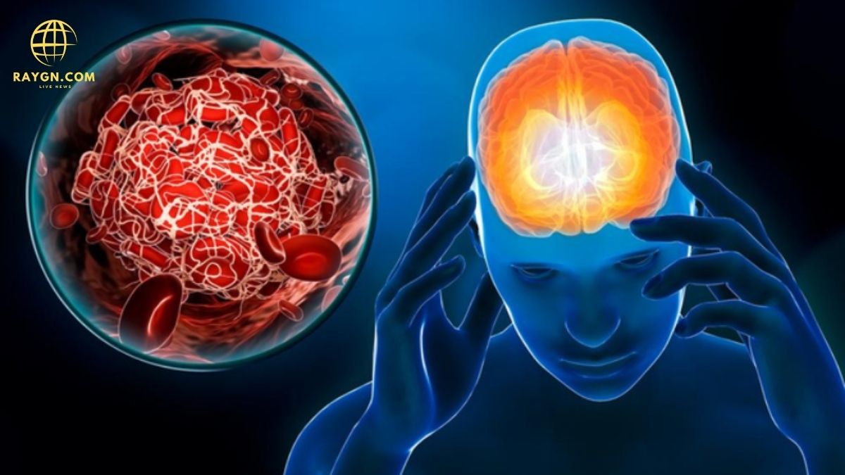 The Signs of Stroke: Early Symptoms You Shouldn't Ignore