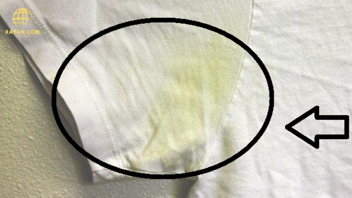 Why You May Notice a Bleach Patch in Your Underwear and What It Means