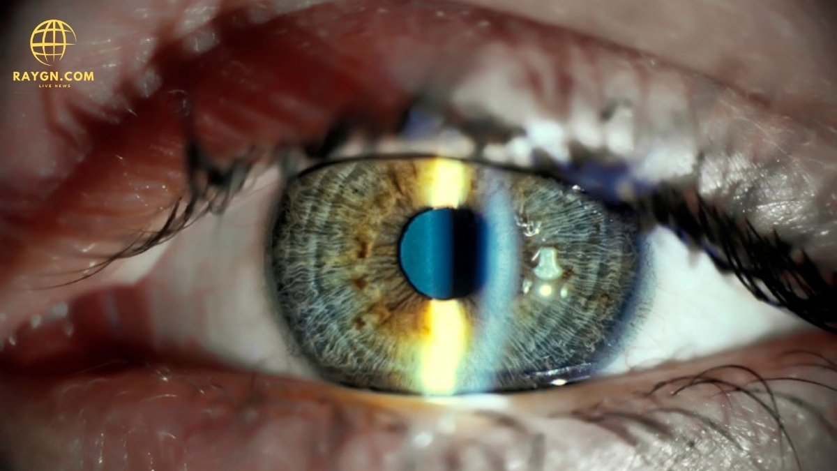 Stem Cell Eye Treatment: Benefits, Procedures, and What You Need to Know