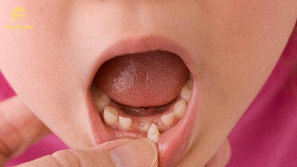 Attention Parents: Why You Should Keep Your Kids’ Baby Teeth