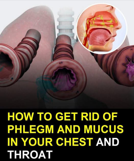 8 Ways To Get Rid Of Phlegm And Mucus In Chest And Throat