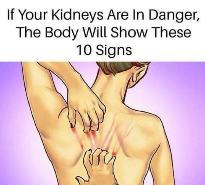 10 Warning Signs of Kidney Disease You Should Never Ignore: Early Detection Tips