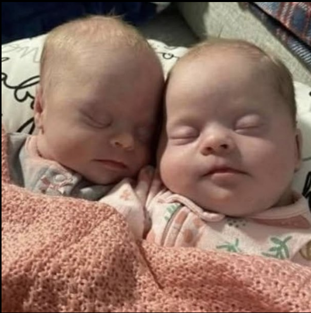 Mom of twins with Down syndrome shuts down critics