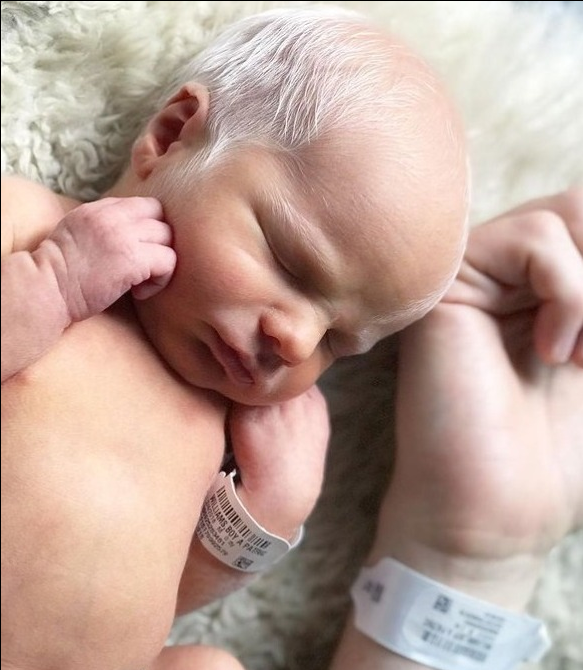 Albino baby mocked for white hair is happy and healthy years later