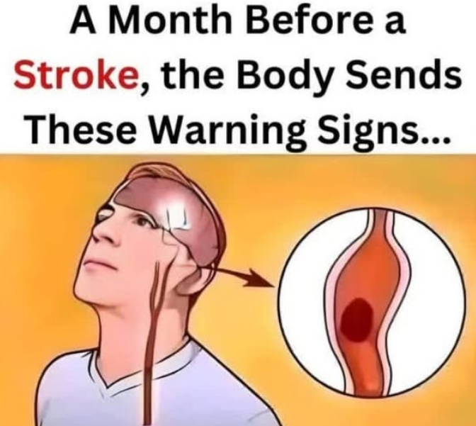 The Signs of Stroke: Early Symptoms You Shouldn’t Ignore