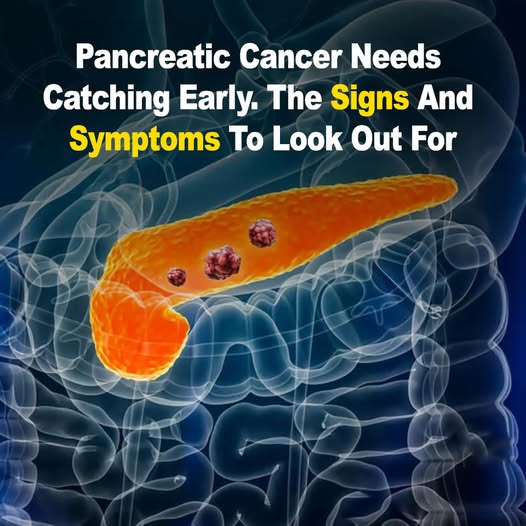 10 Warning Signs of Pancreatic Cancer You Should Never Ignore